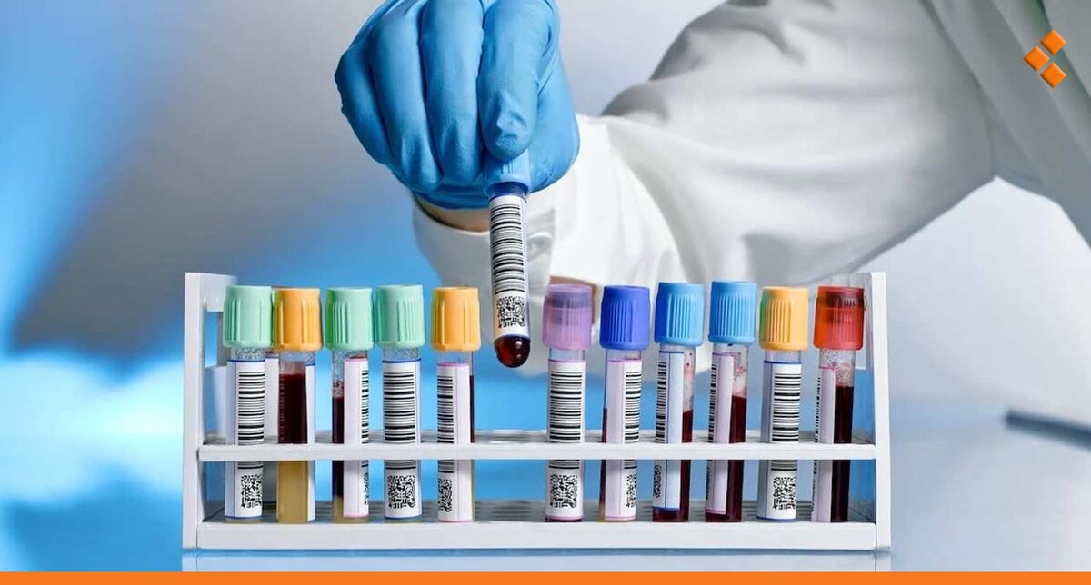 فوضى أسعار التحاليل الطبية في سوريا: المرضى يشكون والتسعيرة الرسمية غائبة